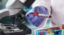 За останню добу в області зареєстрували 40 нових випадків COVID-19